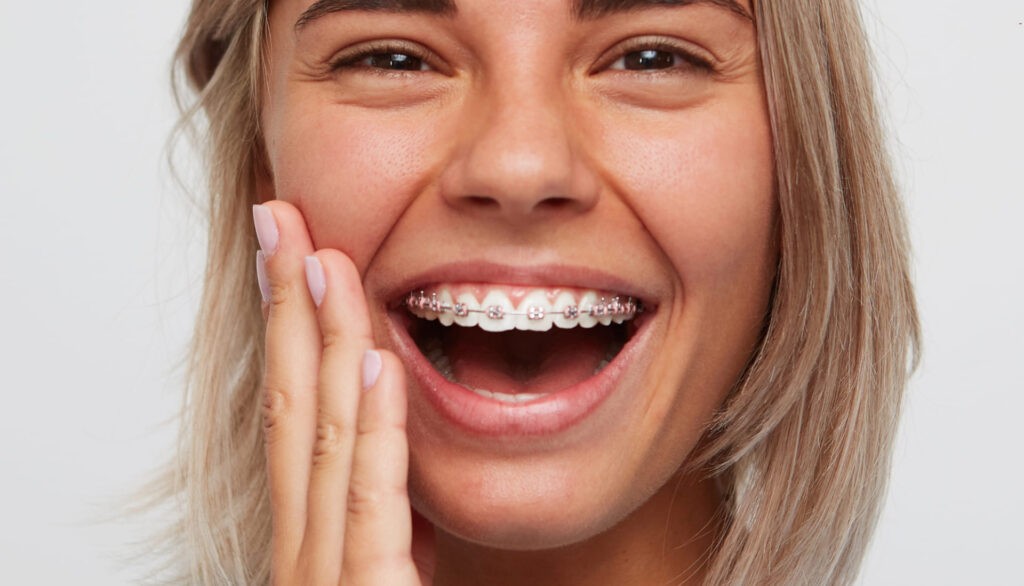 Sourire équilibre au cabinet d'orthodontie du Dr Pascal