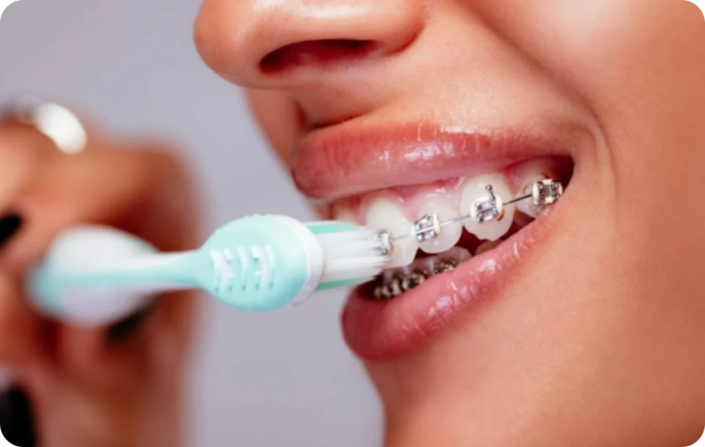 Orthodontiste à Benesse Maremne