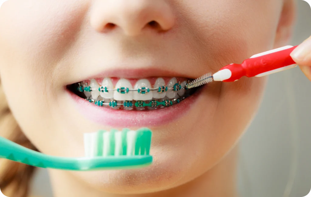 Orthodontiste à Capbreton