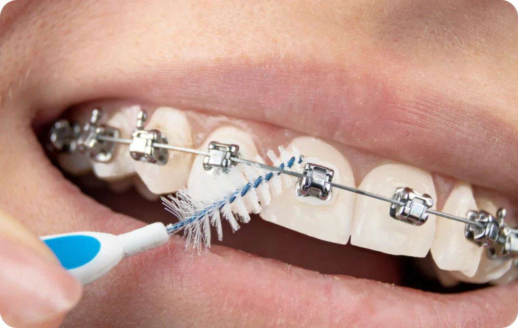 Orthodontiste à Capbreton