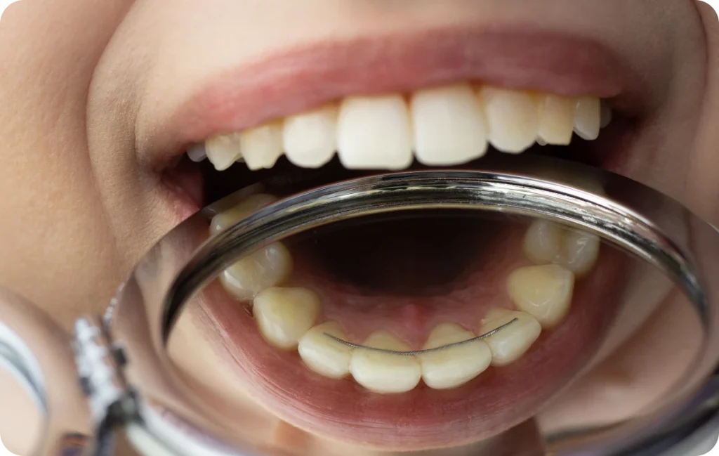 Orthodontiste à Saint Geours de Maremne