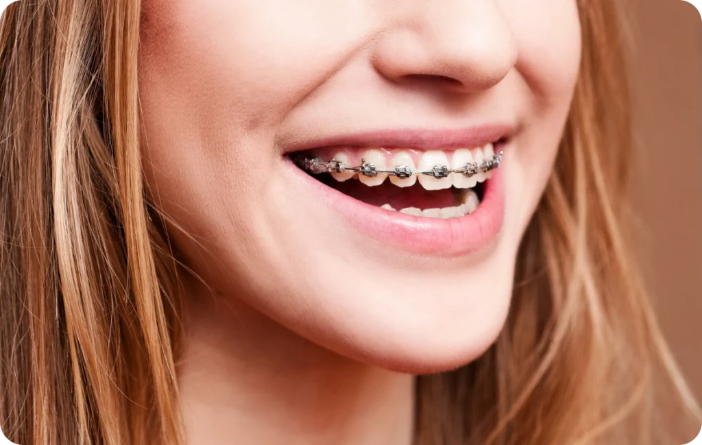 Orthodontiste à Saint Vincent de Tyrosse