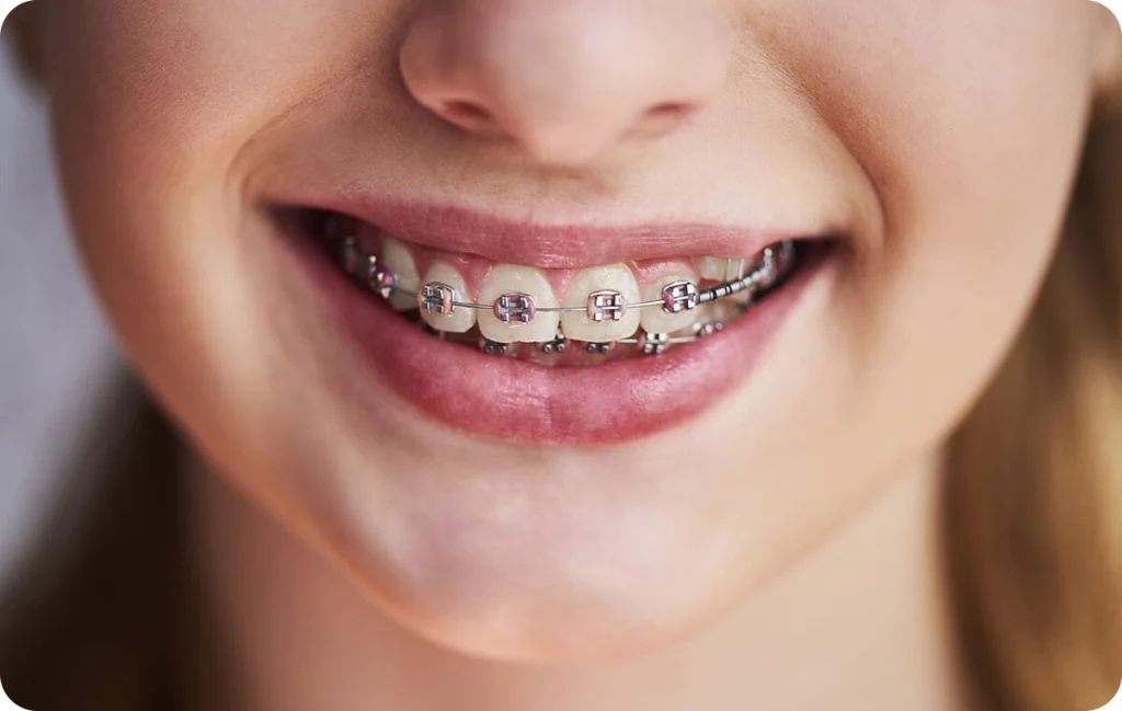 Orthodontiste à Saint Geours de Maremne